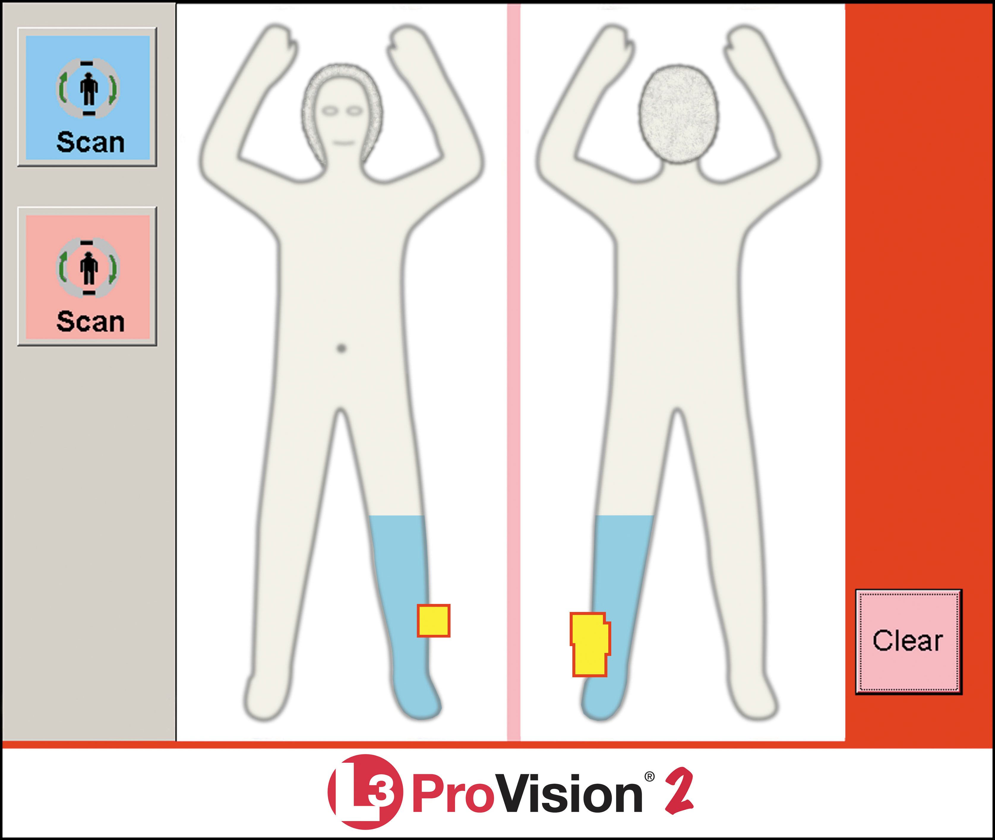 Система бесконтактного досмотра ProVision 2